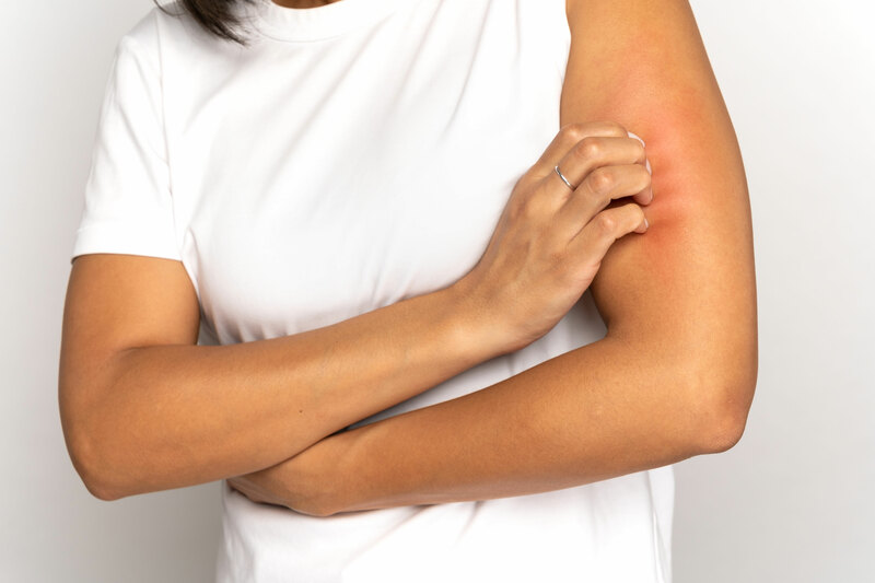A person scratching their irritated skin on their arm while wearing a white cotton t-shirt.